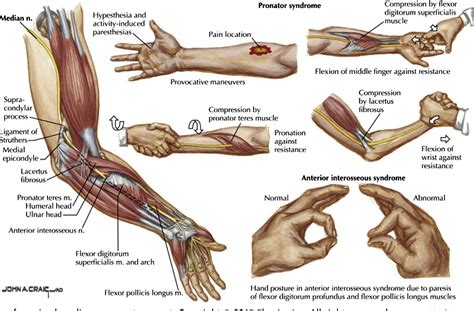 radial nerve compression test|radial nerve entrapment shoulder.